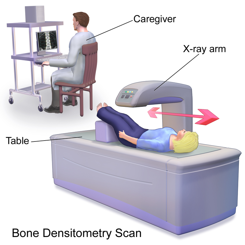800px-Blausen_0095_BoneDensitometryScan.png